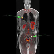 Центр радиологии Мюнхена «Конрадиа», г.Мюнхен, Германия 