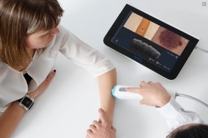 Сканер VivoSight – инновационная диагностика рака кожи в Германии!