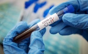 Российские ученые создали тест-систему на определение антител к коронавирусу. Какую роль это сыграет в борьбе с эпидемией?