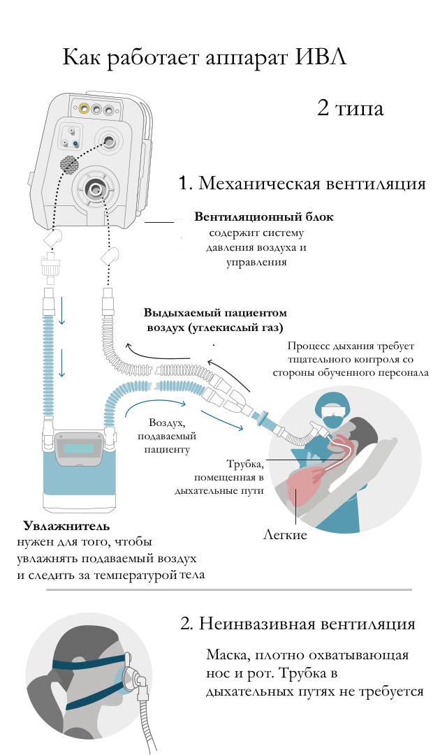 Курсовая работа: Аппарат искусственной вентиляции легких