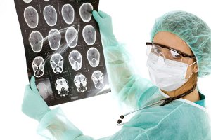 Ученые нашли эффективный метод диагностики метастазов рака в головном мозге